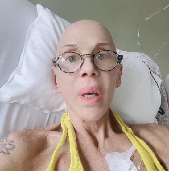 Billur Kalkavan kanserle mücadele ediyor: Kafamdan saç bile çıkıyor