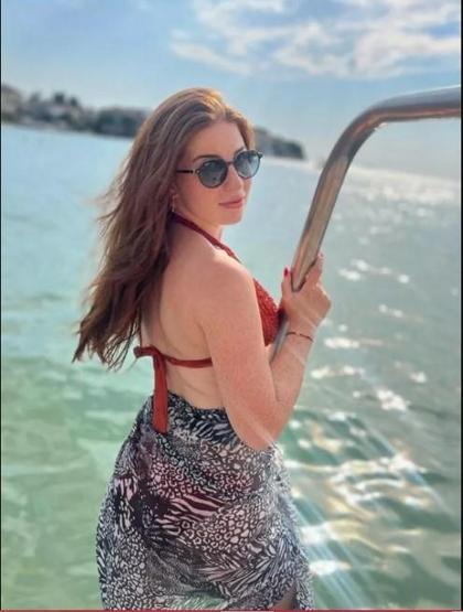Zeynep Özkayanın değişimi şaşırtıyor