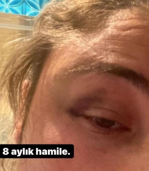 Kaan Boşnak ile boşanma aşamasında olan Başak Ceylan Torun sessizliğini bozdu