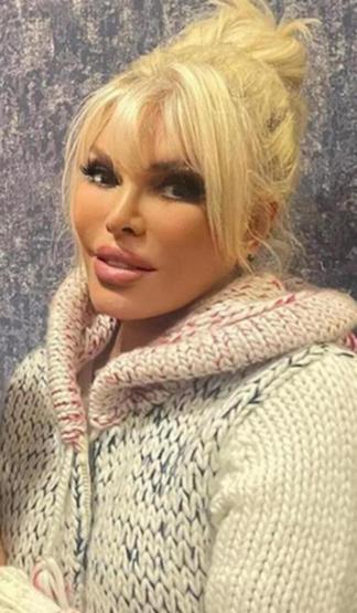 Ajda Pekkanın yüzündeki değişim dikkat çekti