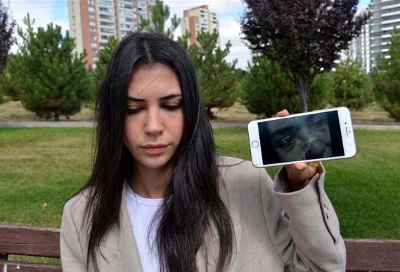 Aydandan burnunu kıran eski sevgilisi için elektronik kelepçe talebi