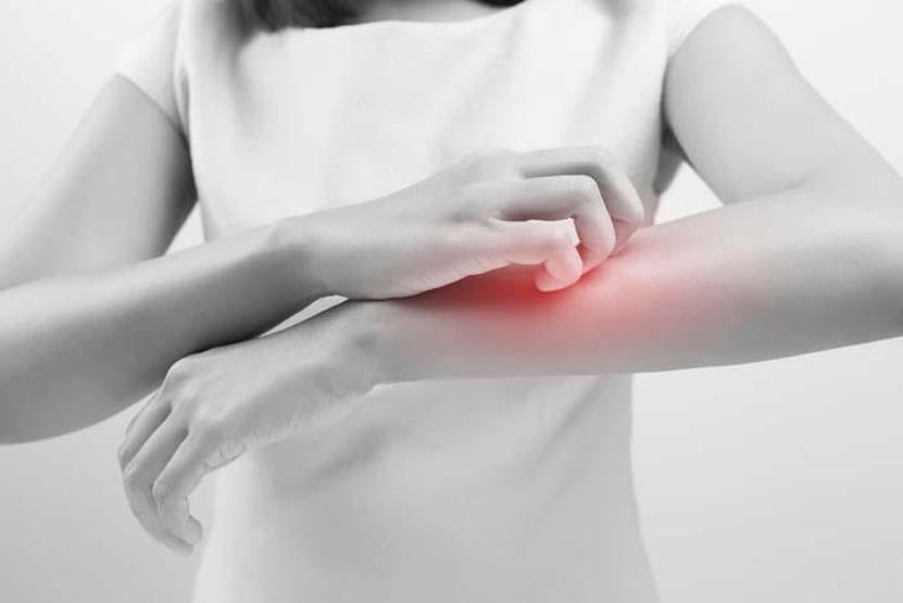 Dermatoloji uzmanından kaşıntı uyarısı