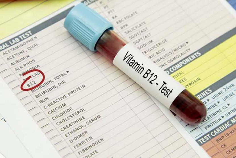 B12 vitamin eksikliği kansızlığa neden oluyor İşte B12 vitaminini alacağınız besinler
