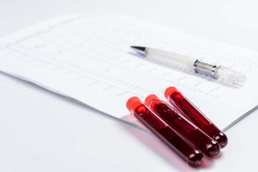 Dünyada yılda 12 milyon kişinin ölümüne neden oluyor Sepsise karşı 10 etkili önlem