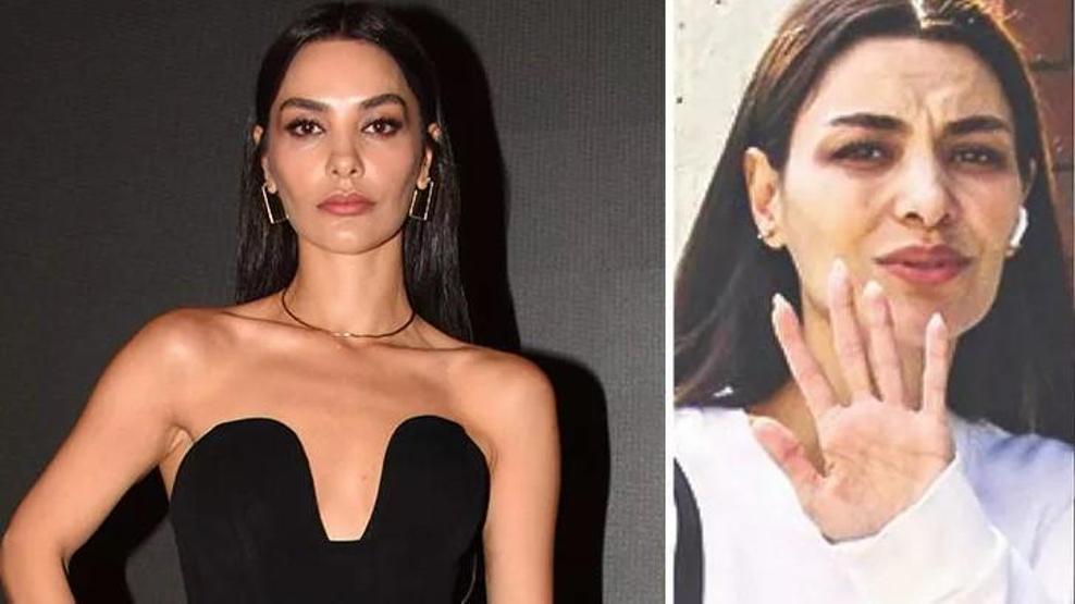 Hazal Filiz Küçükköseden makyajsız fotoğraf sitemi