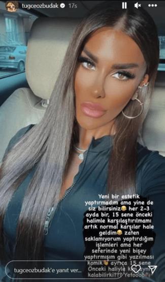 Tuğçe Özbudak estetik haberlerine isyan etti