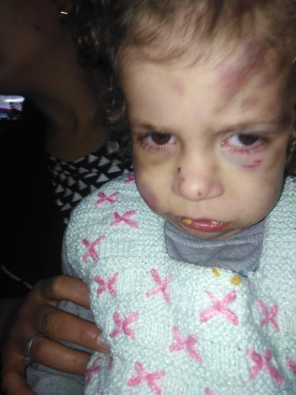 Gaziantep’te kan donduran olay 5 yaşındaki çocuğuna günlerce işkence ederek aç bıraktı