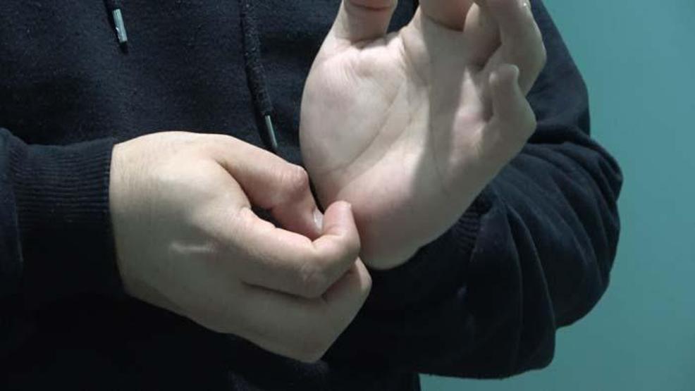 Son yılların korkulu rüyası İnsandan insana bulaşabiliyor Bu belirtiyi dikkate alın... Uzman isimden uyarı geldi: Hasta sayısında artış yaşanıyor