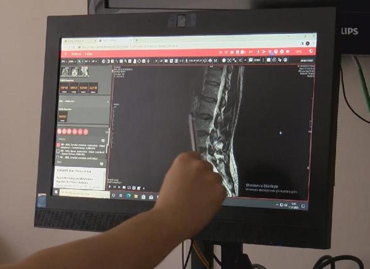 Kalçadan bacağa vuran ağrı, bel fıtığının habercisi