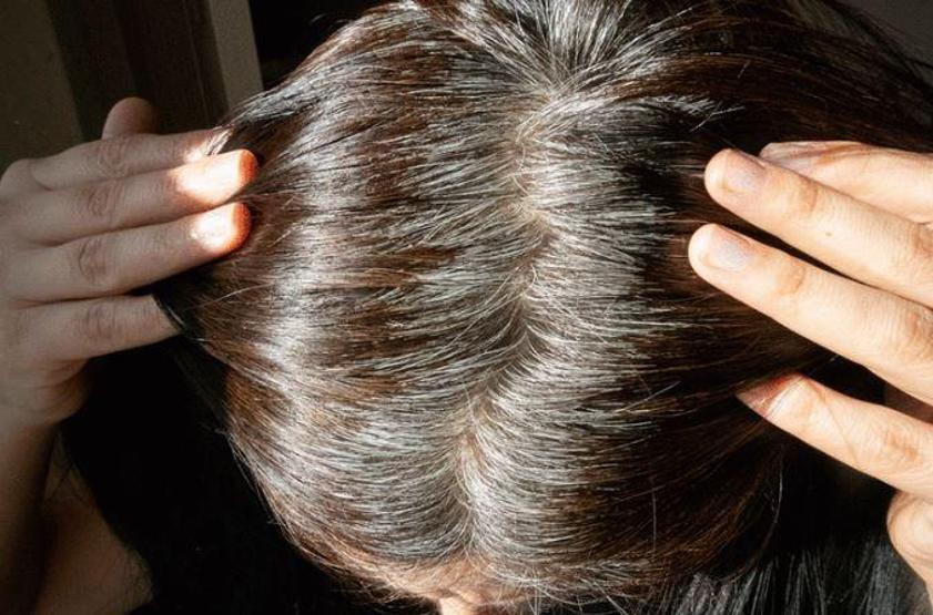 Bu vitamini vücudunuzdan eksik etmeyin Eksikliği saçları erkenden beyazlatıyor