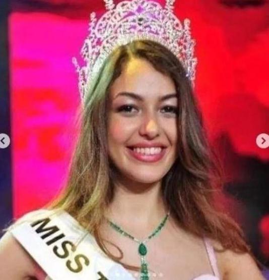 Dilan Çiçek Deniz değişimiyle tekrar gündeme geldi