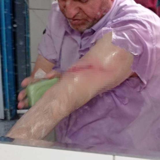 Okul bahçesinde dehşeti yaşadılar Sahipsiz köpek öğretmen ve öğrenciye saldırdı
