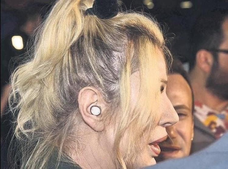 Seda Sayan’ın kulağına ne oldu Taktığı işitme cihazı korkuttu