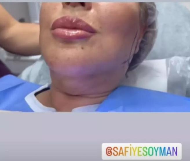 Seda Sayan önerdi, Safiye Soyman ameliyat oldu