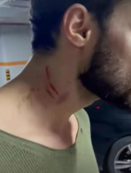 Batuhan Karacakayanın eski sevgilisi Ayşe Aslanpayı darp ettiği iddia edildi