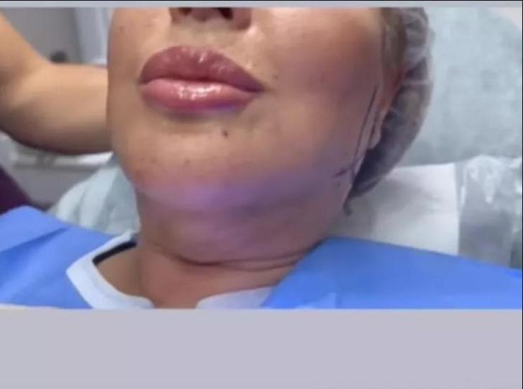 Safiye Soyman’ın son hali olay oldu
