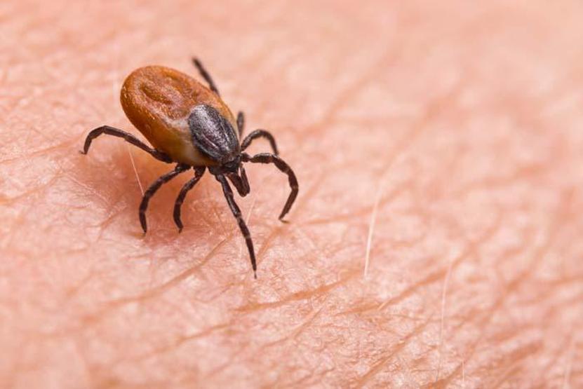 Taklitçi hastalık Lyme: Semptomların belirsizliği teşhisi zorlaştırıyor