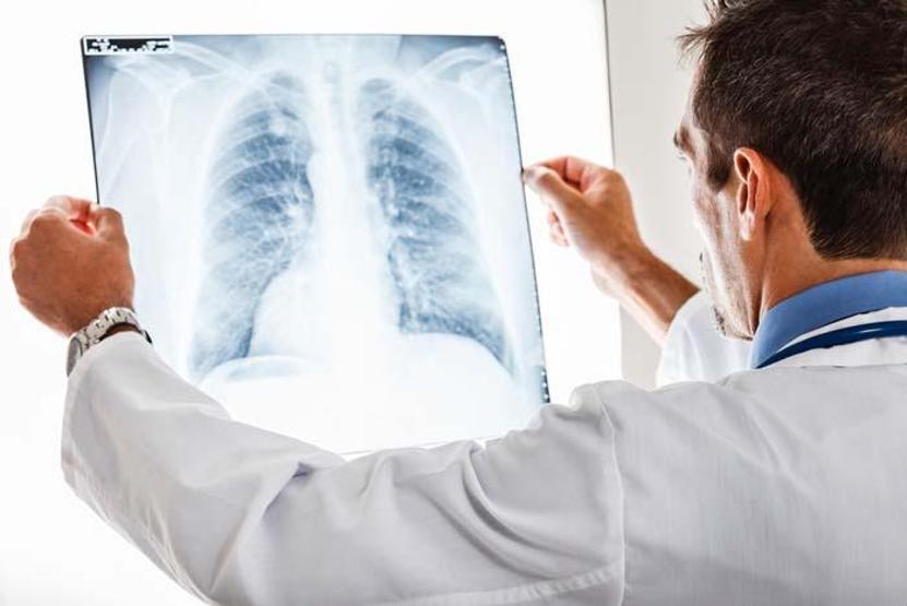 Elektronik salgın Kısırlık riskini 10 kat artırıyor Akciğerden kalbe etkilemediği organ yok
