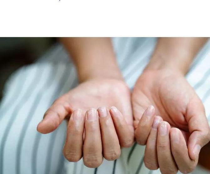 Vücudunuzdaki işaretlere dikkat O hastalığın alarmını veriyor...