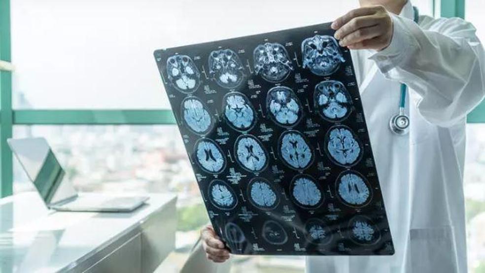 Sık sık unutuyorsunuz dikkat Tehlikeli hastalığın habercisi olabilir