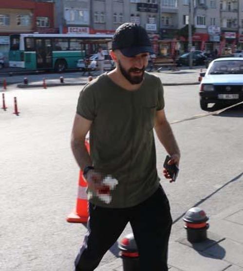 Acemi kasaplar hastanelik oldu
