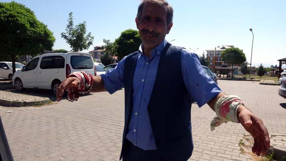 Acemi kasaplar hastanelik oldu