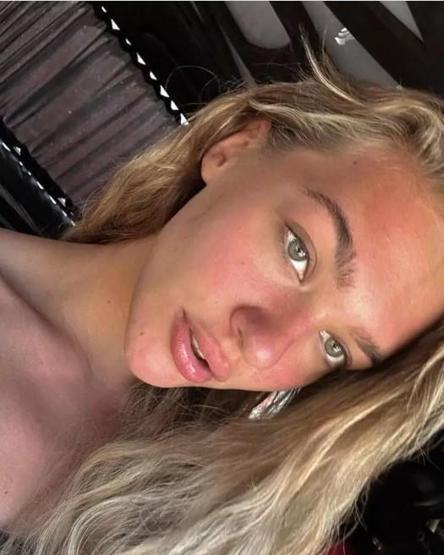 Melisa Döngelden makyajsız kareler: Estetiğe hayır