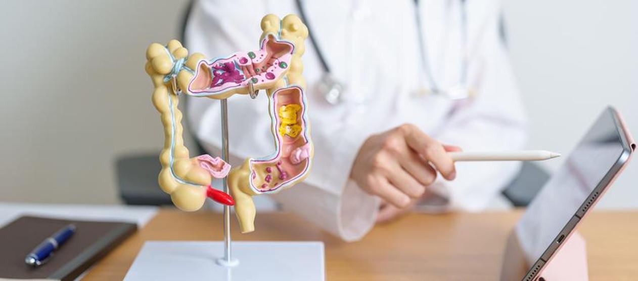 Crohn hastalığı nedir, neden olur Crohn hastalığı belirtileri ve tedavisi