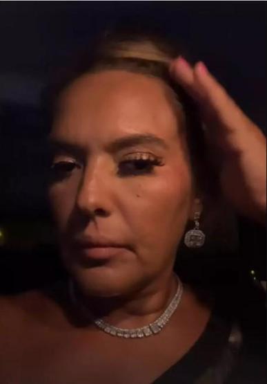 Demet Akalın talihsiz bir kaza geçirdi