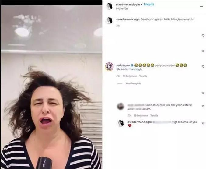 Esra Dermancıoğlu, yüzünü çorapla gerdirip estetik yaptıranları tiye aldı