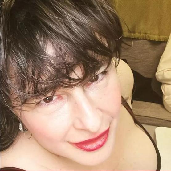Esra Dermancıoğlu, yüzünü çorapla gerdirip estetik yaptıranları tiye aldı