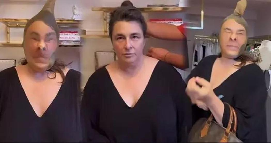 Esra Dermancıoğlu, yüzünü çorapla gerdirip estetik yaptıranları tiye aldı