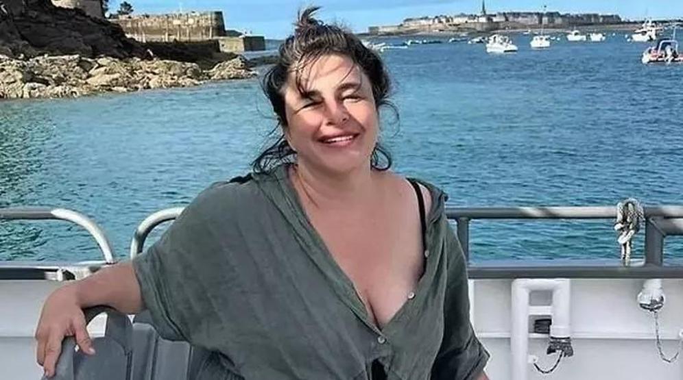Esra Dermancıoğlu, yüzünü çorapla gerdirip estetik yaptıranları tiye aldı