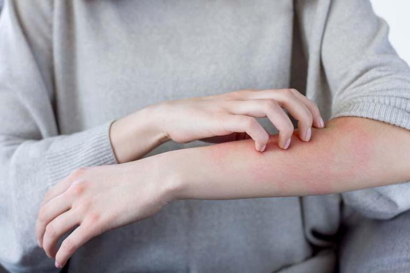 Uyuz vakaları yüzde 30 arttı, bazı kremlere direnç göstermeye başladı Uyuz nasıl geçer Sirke veya sirkeli su işe yarıyor mu Dermatoloji Uzmanı açıkladı