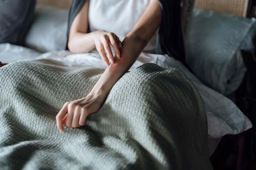 Uyuz vakaları yüzde 30 arttı, bazı kremlere direnç göstermeye başladı Uyuz nasıl geçer Sirke veya sirkeli su işe yarıyor mu Dermatoloji Uzmanı açıkladı