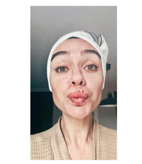 Ünlü oyuncu Birce Akalay hayranlarını korkuttu