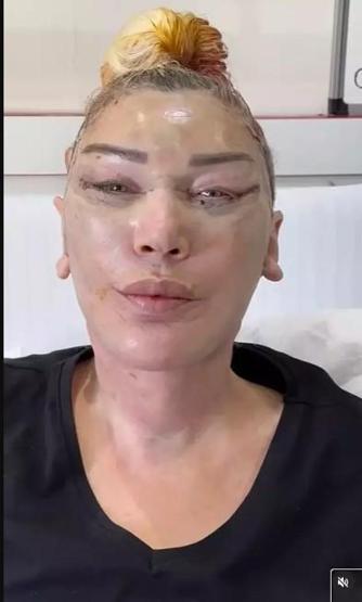 Seda Sayan’ın ablasının son halini görenler değişime inanamadı