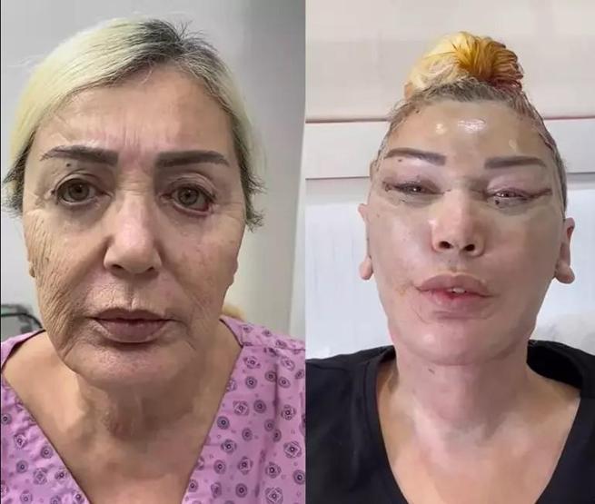 Seda Sayan’ın ablasının son halini görenler değişime inanamadı