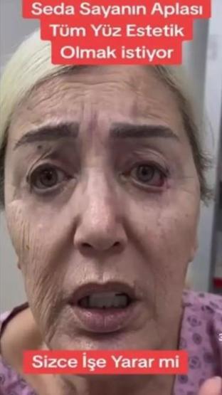 Seda Sayan’ın ablasının son halini görenler değişime inanamadı