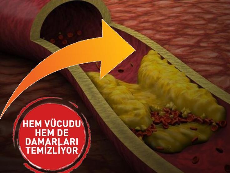 Bu Besinleri Bol Bol Tüketin Hem Vücudu Hem De Damarları temizliyorlar: Uzmanlar diyor ki...