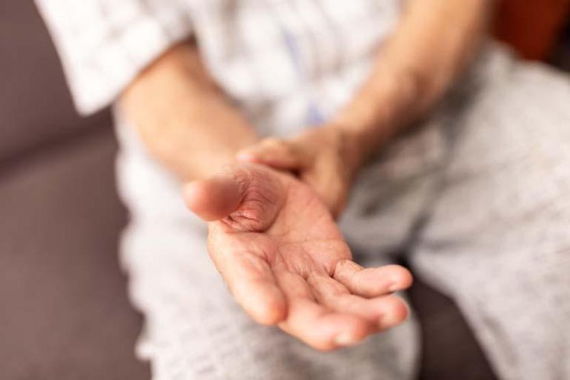 Ayak başparmağındaki dayanılmaz ağrıya dikkat Artık gençlerde de görülüyor Uzman isim uyardı: Diğer romatizmal hastalıklarla karıştırılabilir