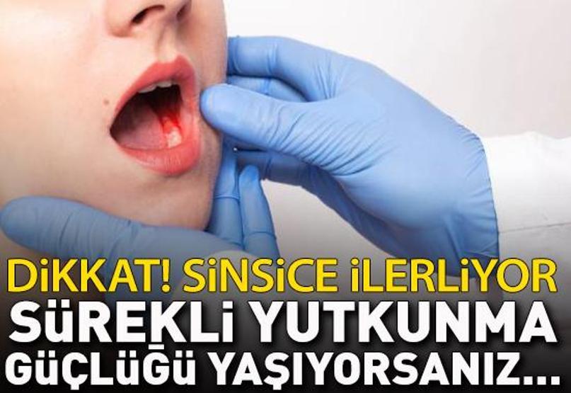 Dikkat Sinsice ilerliyor... Bu şikayetleri hafife almayın: 3 haftadan uzun süren yutkunma güçlüğü, boyunda şişlik...
