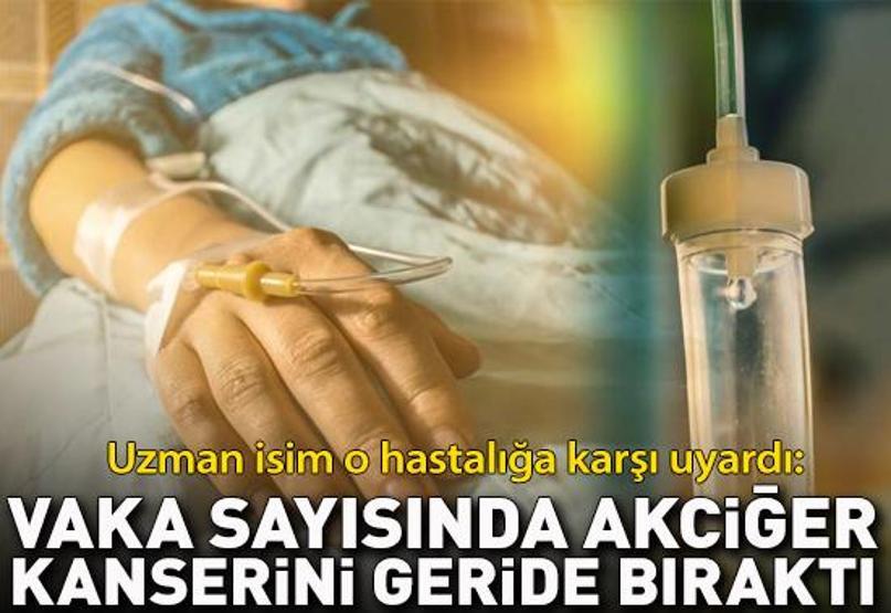 Uzman isim o hastalığa karşı uyardı: Vaka sayısında akciğer kanserini geride bıraktı