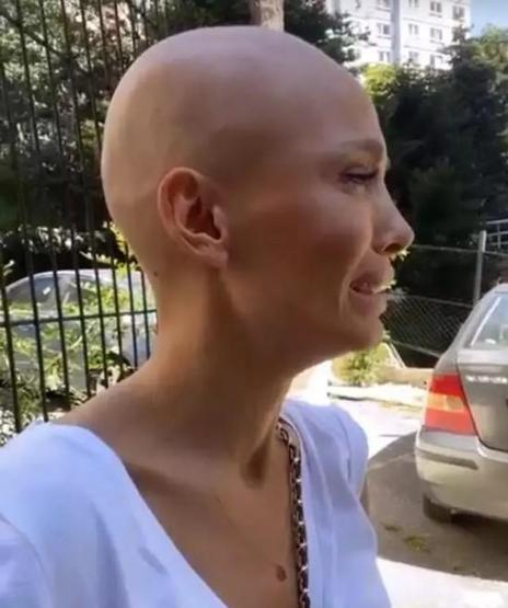 Şarkıcı Şimal’den sağlık durumuna ilişkin yeni açıklama