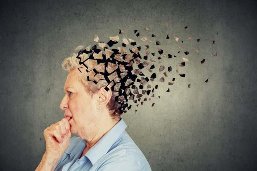 Demans vakalarının yüzde 50 ila 70’i Alzheimer kaynaklı