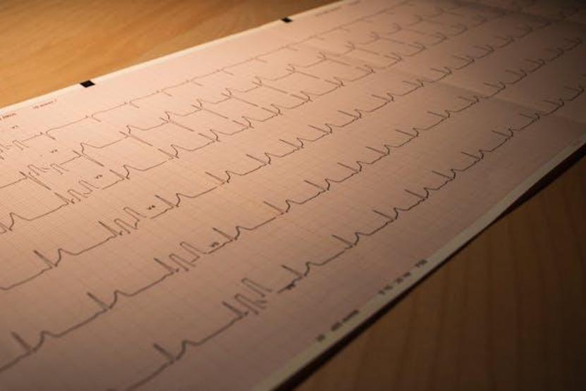 Bunları yapmadan önce bir daha düşünün Kalp krizi riskini tam 5 kat artırıyor