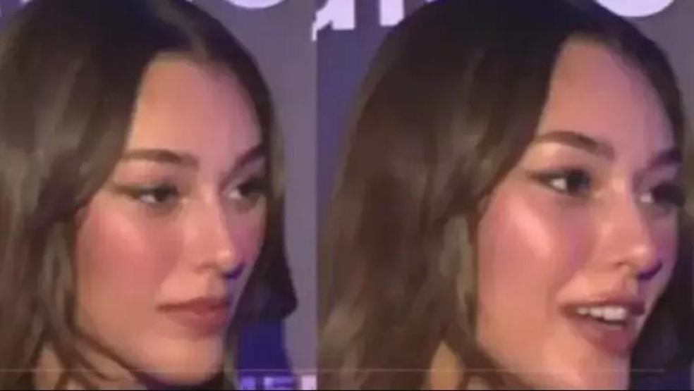 Dilan Çiçek Deniz pozlarıyla gündemde: Dolgularını mı erittin