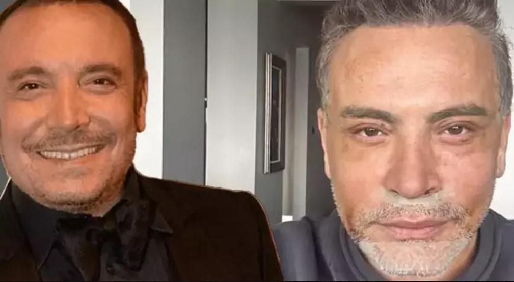 Cenk Erenin estetik faturası ortaya çıktı Fiyatı dudak uçuklattı