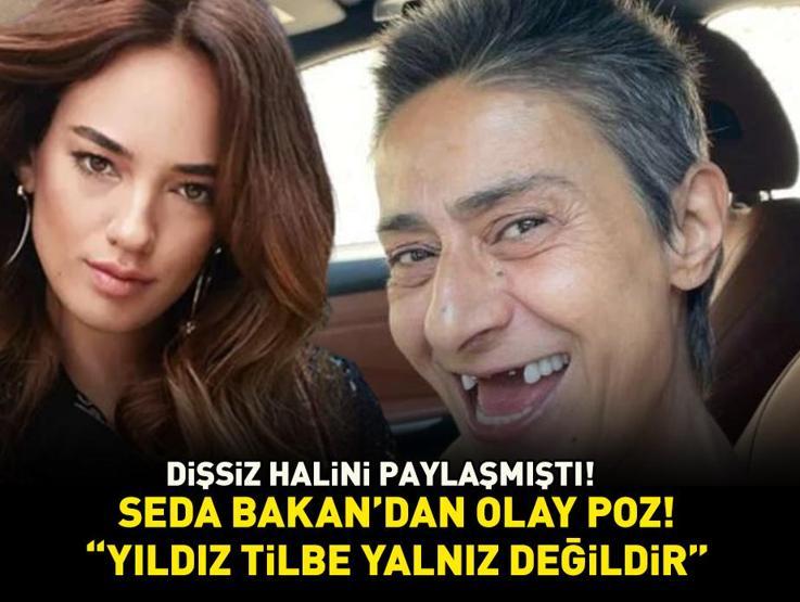 Dişsiz halini paylaşmıştı Seda Bakandan olay poz: Yıldız Tilbe yalnız değildir
