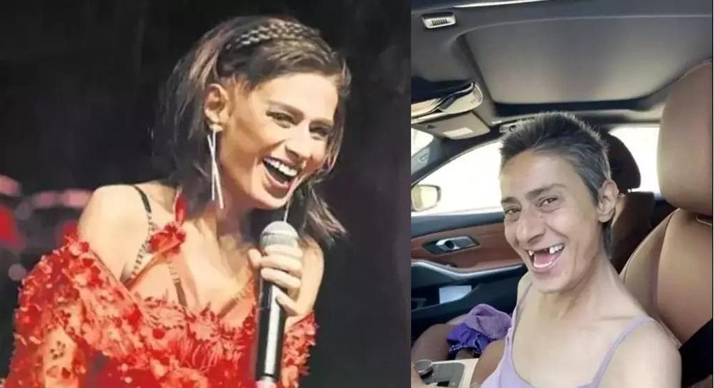 Dişsiz halini paylaşmıştı Seda Bakandan olay poz: Yıldız Tilbe yalnız değildir